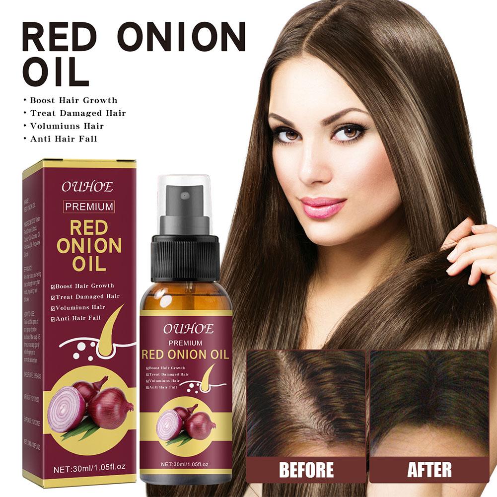 1/3/5PCS Red Onion Essential O - огляд і ціна Hair Care With Rice Water