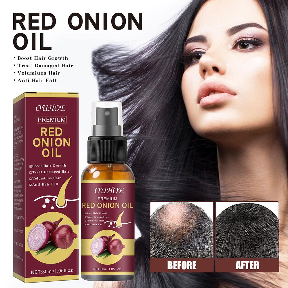 1/3/5PCS Red Onion Essential O - огляд і ціна Hair Care With Rice Water