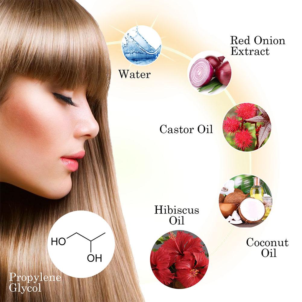 1/3/5PCS Red Onion Essential O - огляд і ціна Hair Care With Rice Water