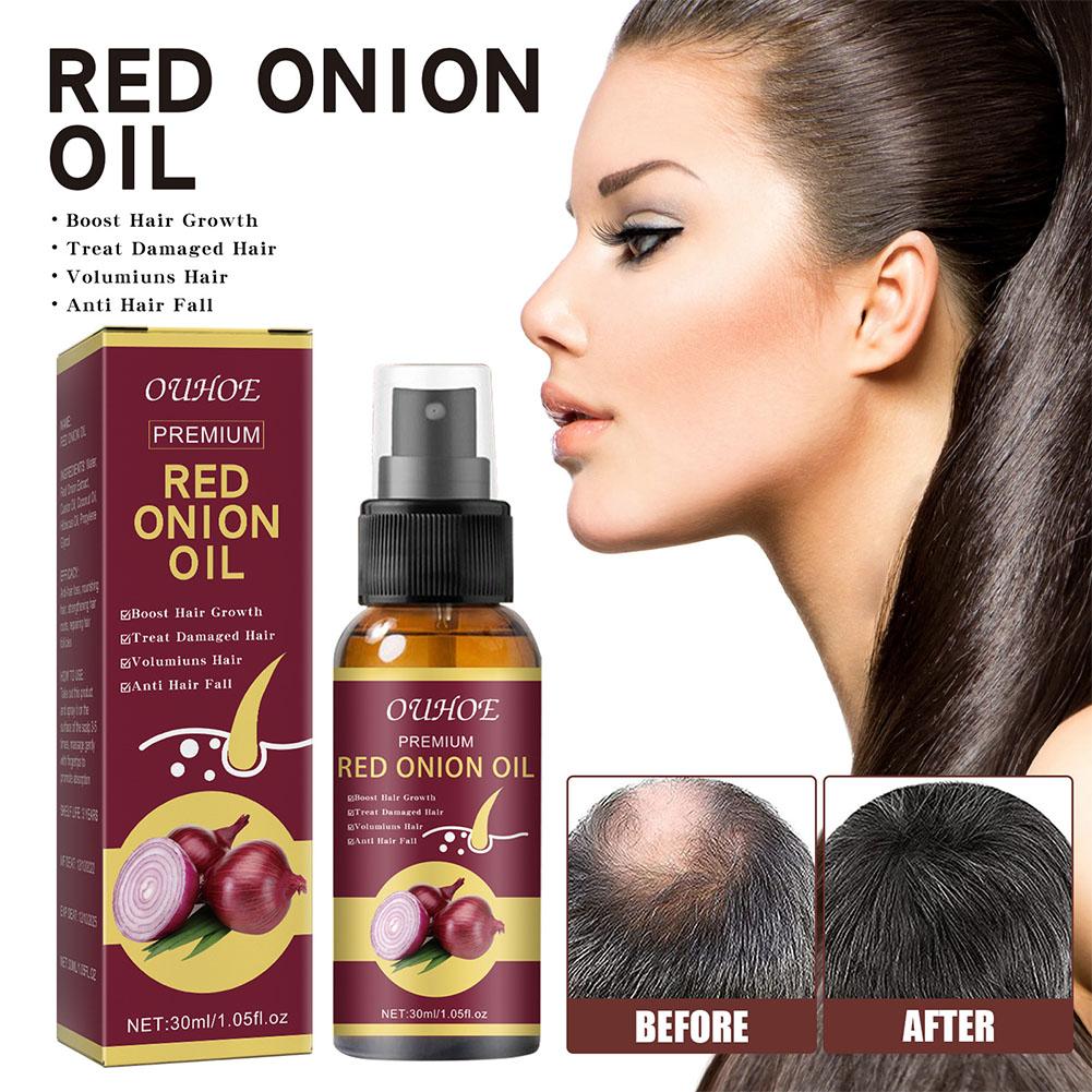 1/2/3pcs Red Onion Essential O - огляд і ціна Hair Care With Rice Water