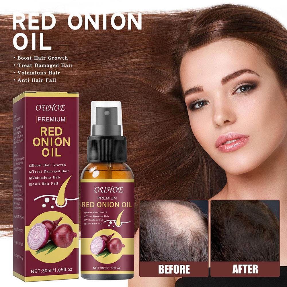 1/2/3pcs Red Onion Essential O - огляд і ціна Hair Care With Rice Water
