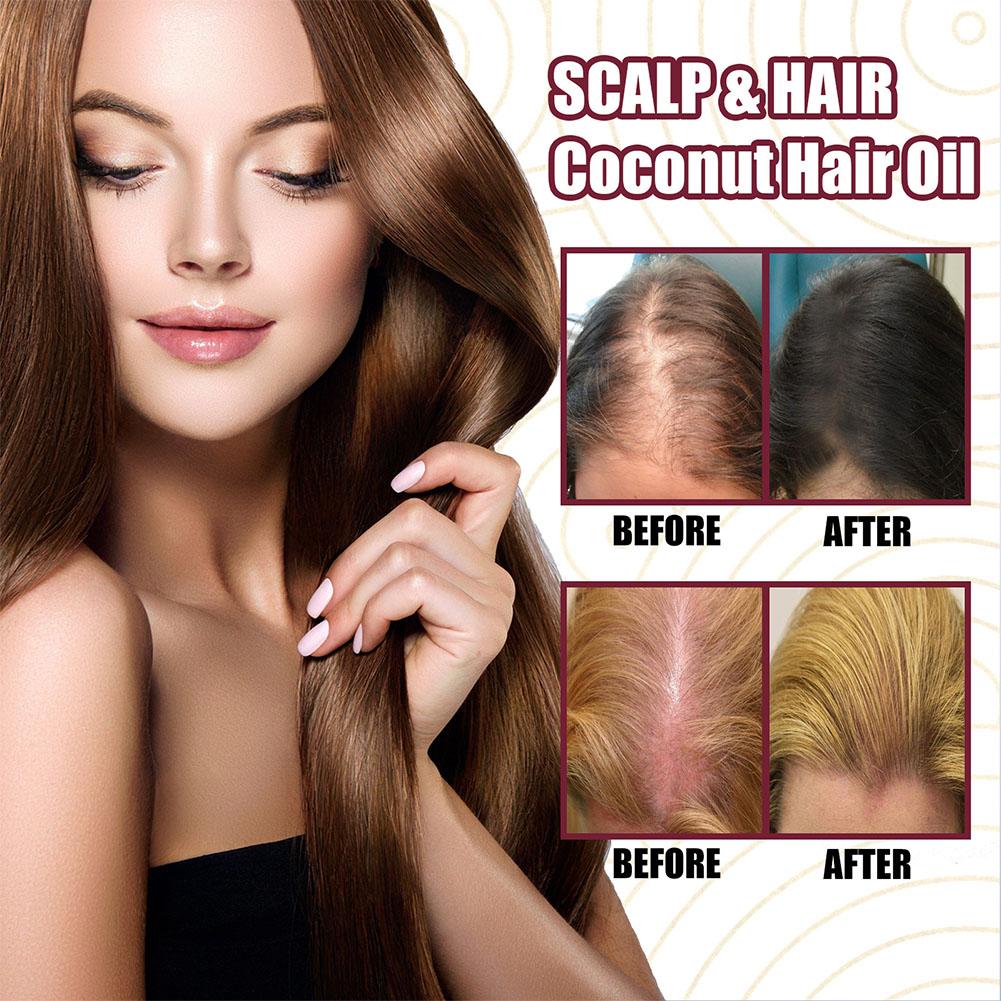 1/2/3pcs Red Onion Essential O - огляд і ціна Hair Care With Rice Water