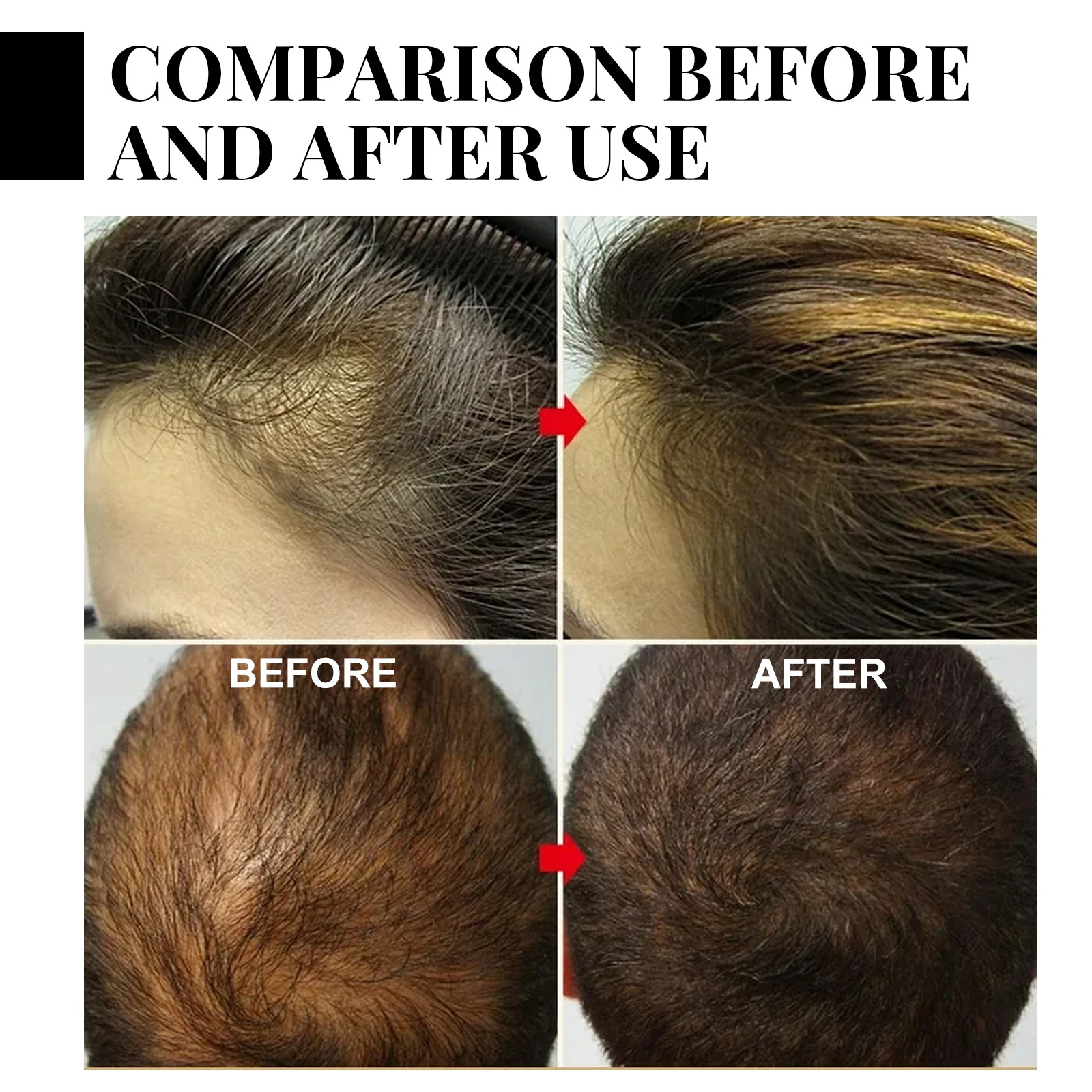 Ginger Hair Growth spray Anti  - огляд і ціна Hair Care With Protein