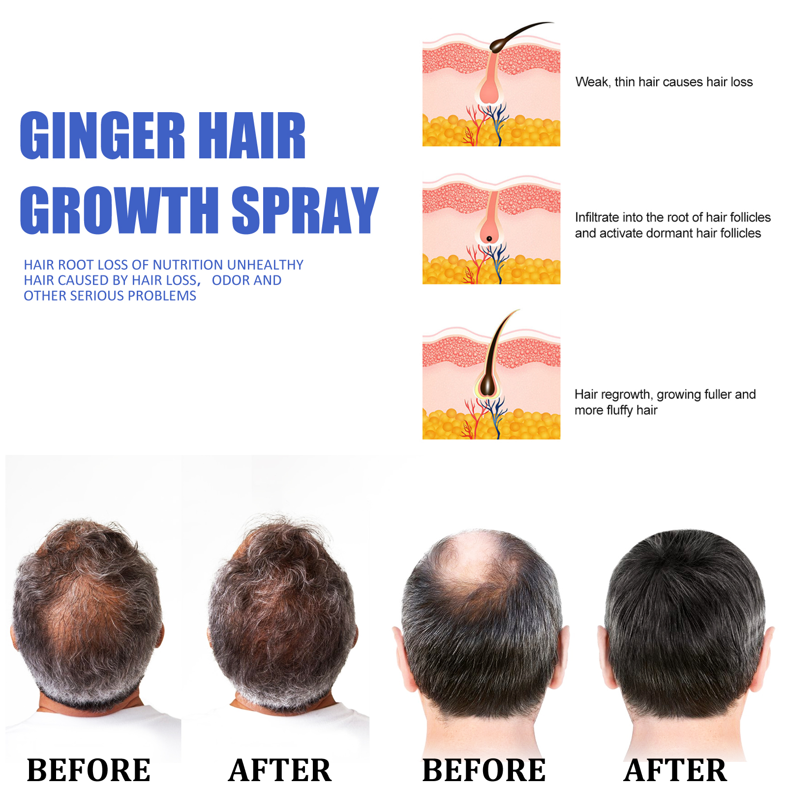 Ginger Hair Growth spray Anti  - огляд і ціна Hair Care With Protein