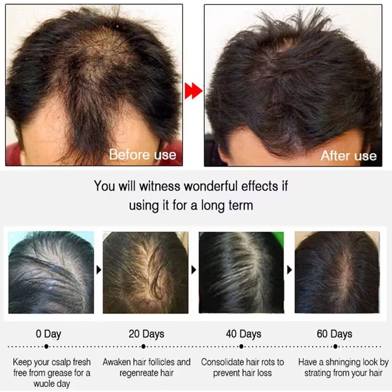 Ginger Hair Growth spray Anti  - огляд і ціна Hair Care With Protein